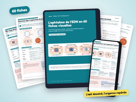 OphtaFiches — 60 fiches visuelles d'ophtalmologie pour l'EDN